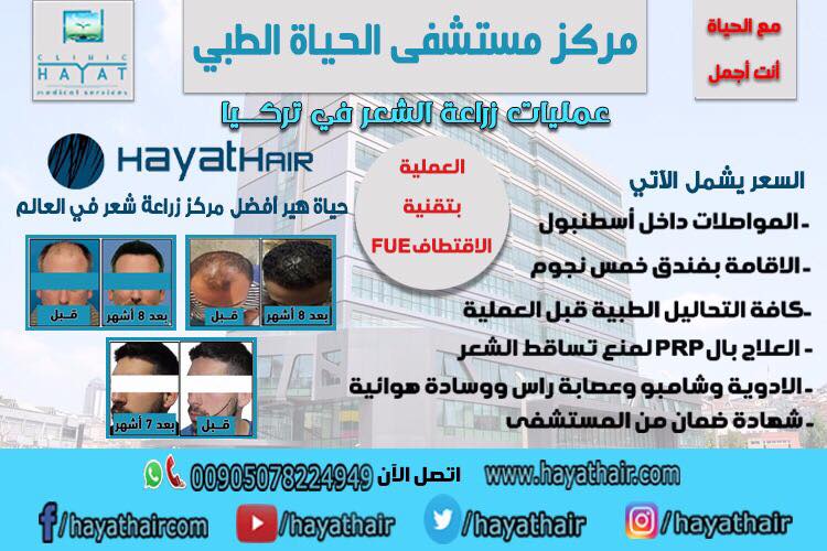 عملية زراعة الشعر في تركيا
