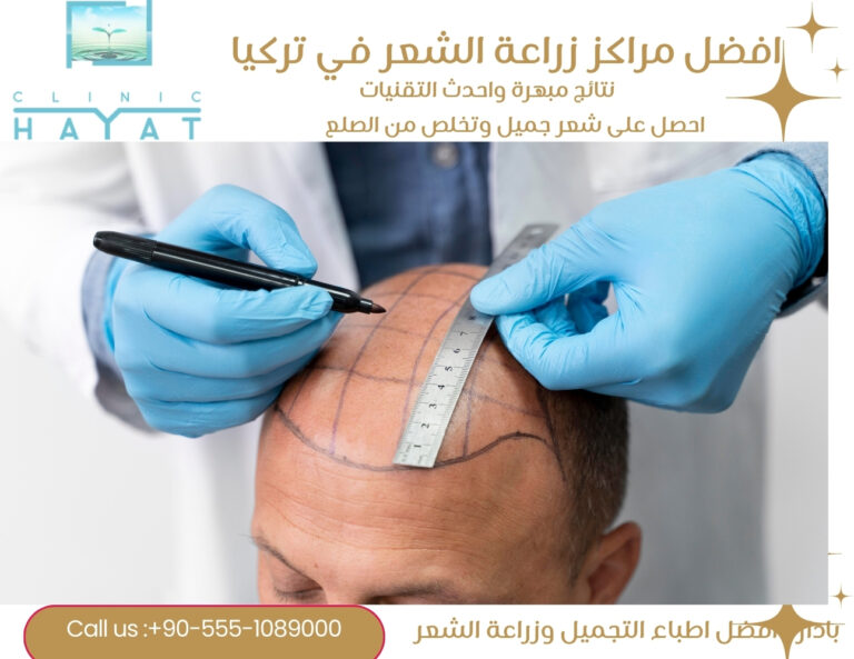 افضل مراكز زراعة الشعر في تركيا