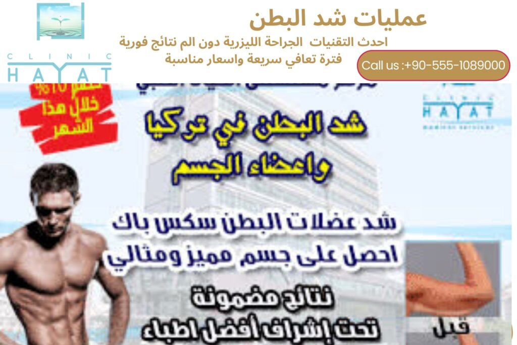 شد البطن في تركيا