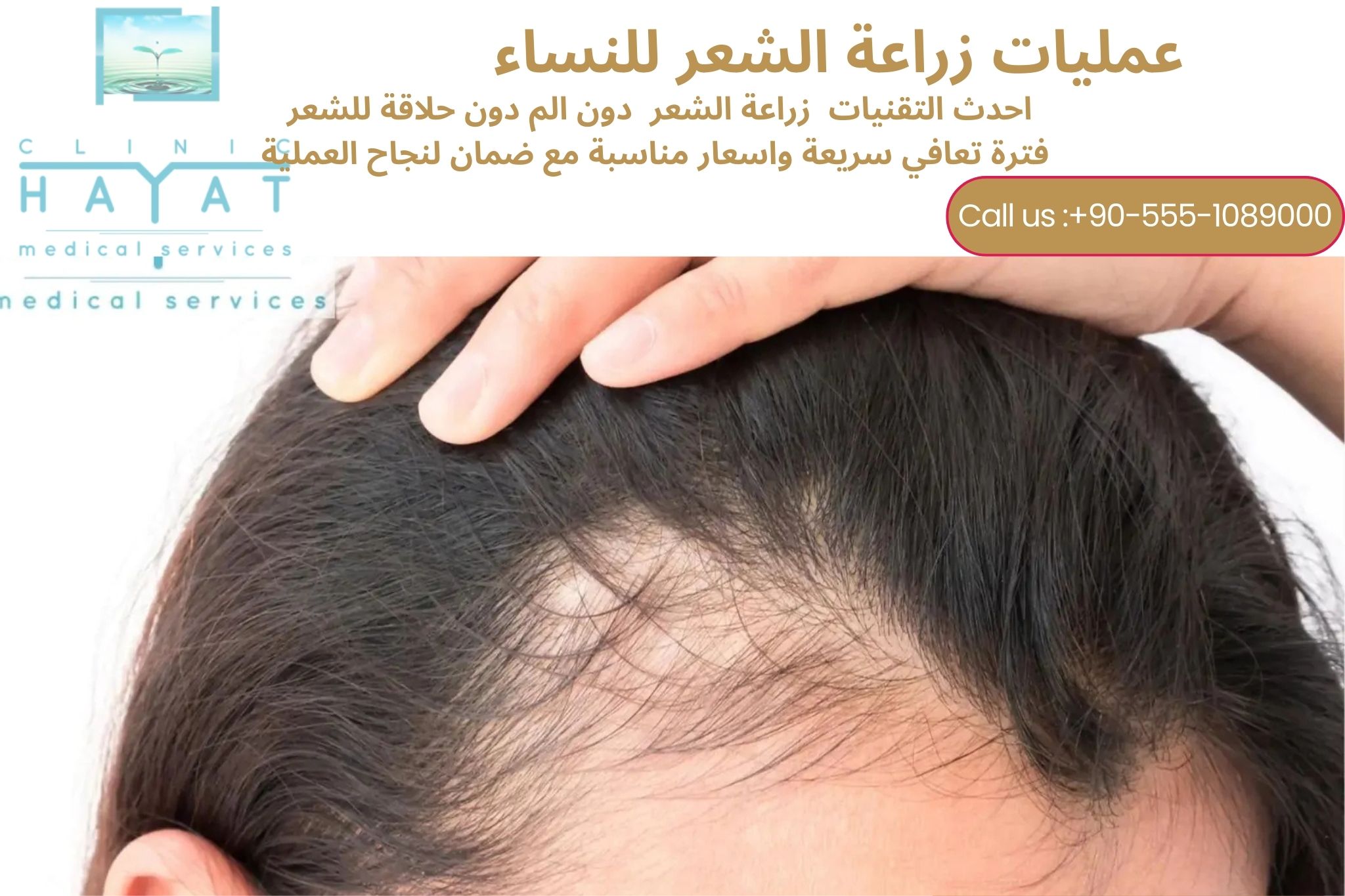 زراعة الشعر للنساء في تركيا