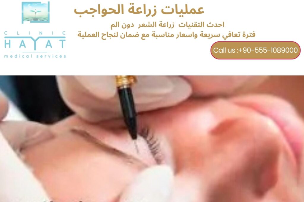 زراعة الحواجب في تركيا