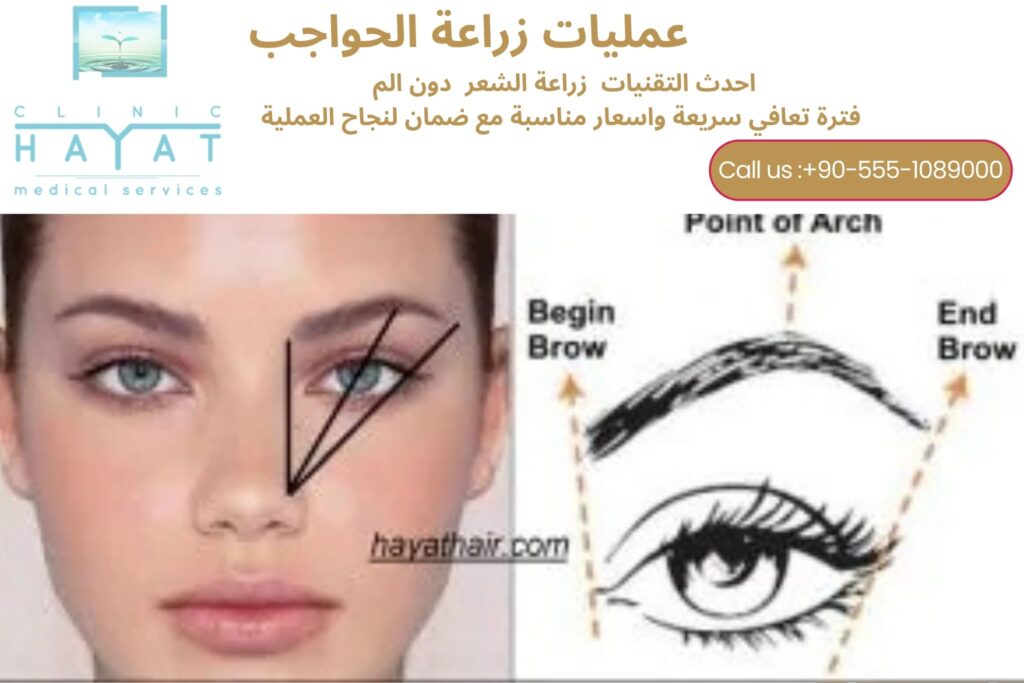 زراعة الحواجب في تركيا