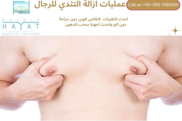 علاج وازالة التثدي عند الرجال في تركيا