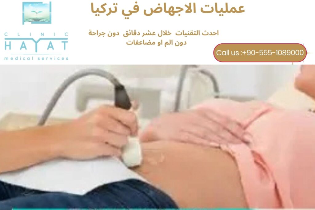 عمليات الاجهاض في تركيا