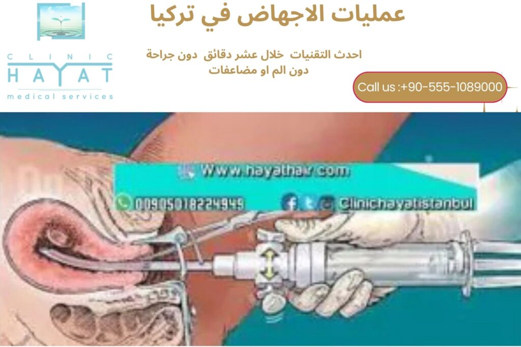 عمليات الاجهاض في تركيا