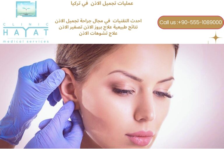 تجميل الاذن في تركيا