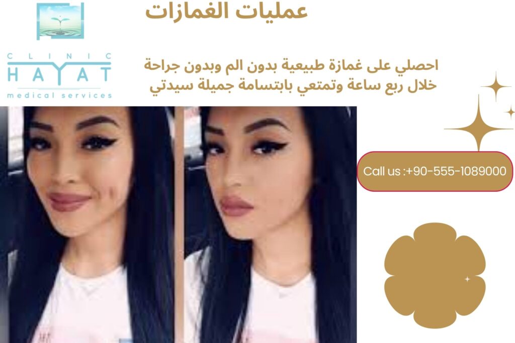 عملية الغمازات في تركيا