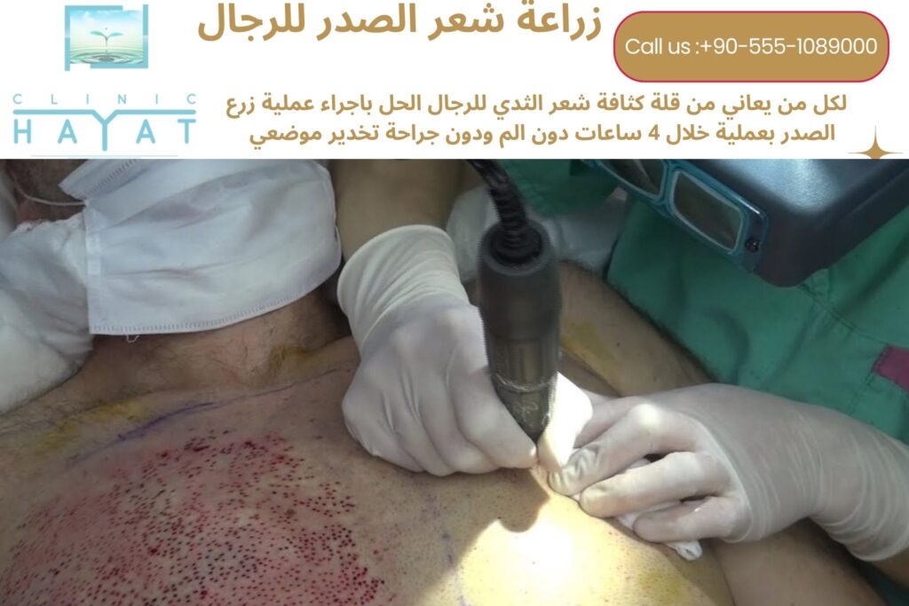 زراعة شعر الصدر في تركيا