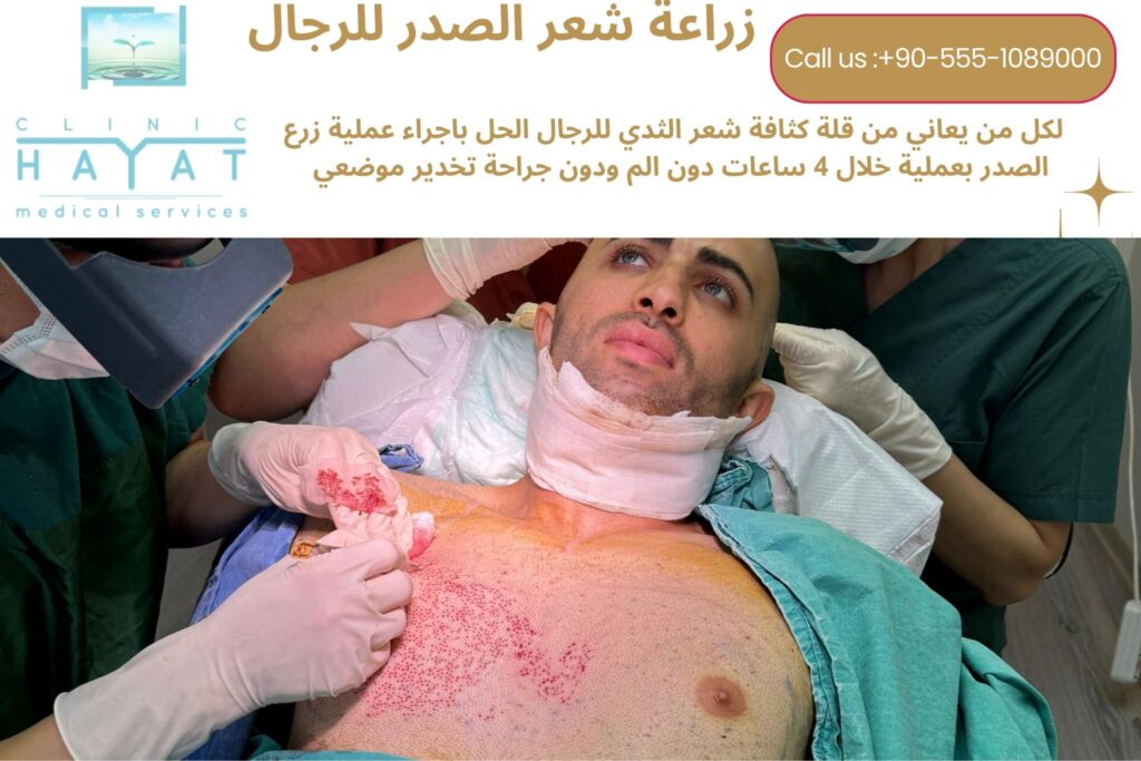 زراعة شعر الصدر في تركيا