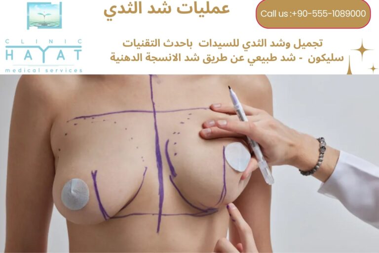 شد ورفع الثدي في تركيا