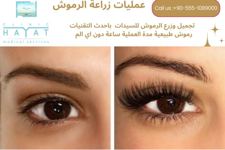 زراعة الرموش في تركيا