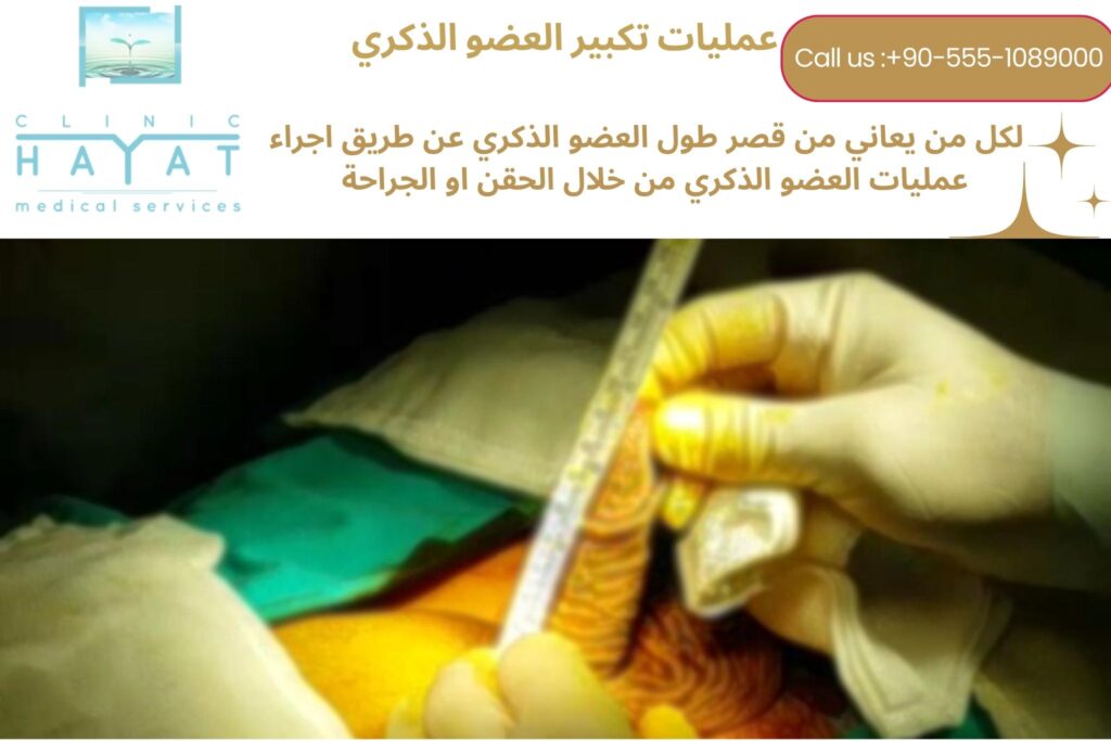 تطويل وتكبيرالعضوالذكري في تركياا