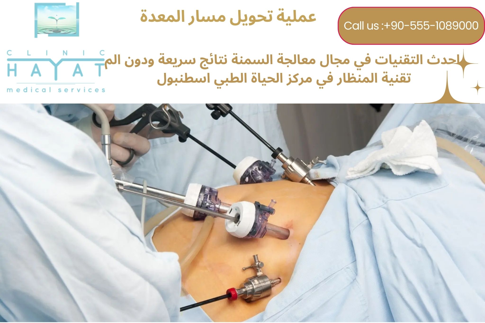 عملية تحويل مسار المعدة في تركيا