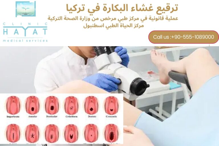 ترقيع غشاء البكارة في تركيا