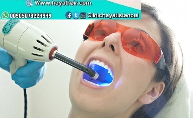 تبييض الاسنان في تركيا