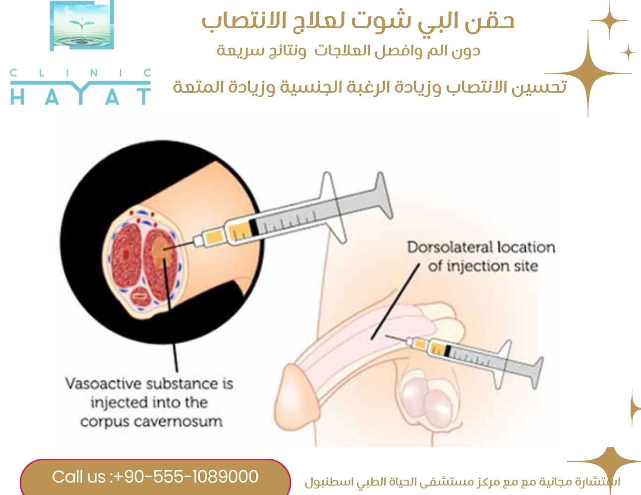 حقن البي شوت لعلاج الانتصاب في تركيا