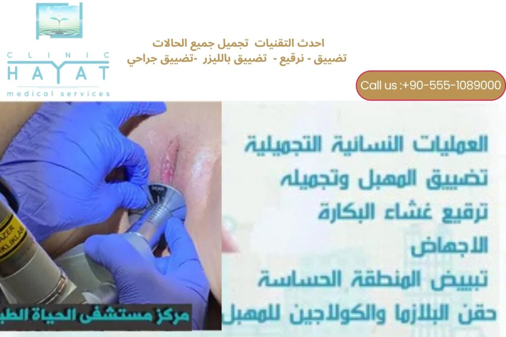 تقنيات تضييق المهبل في تركيا