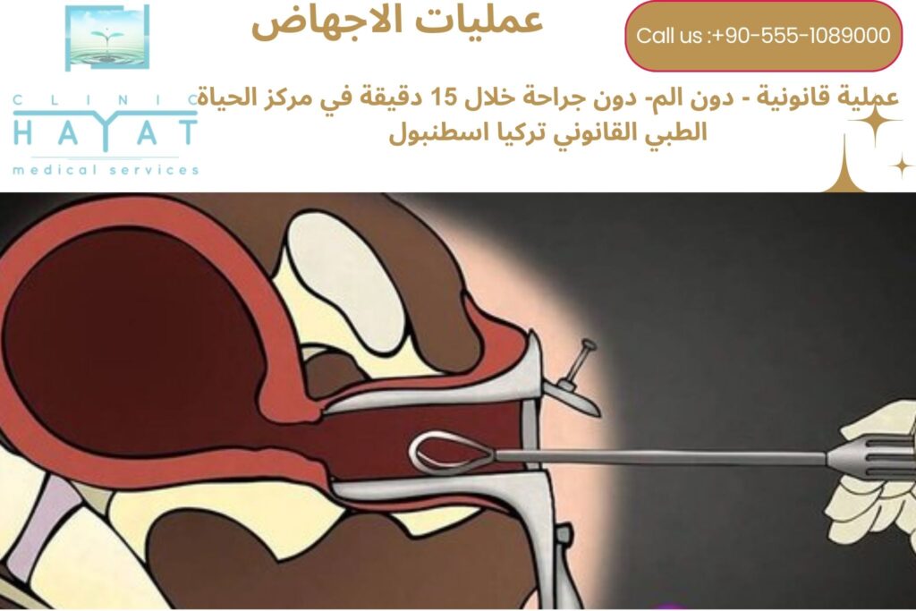 عمليات الإجهاض