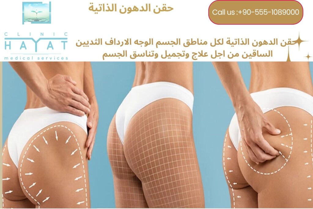 خطوات حقن الدهون الذاتية في تركيا