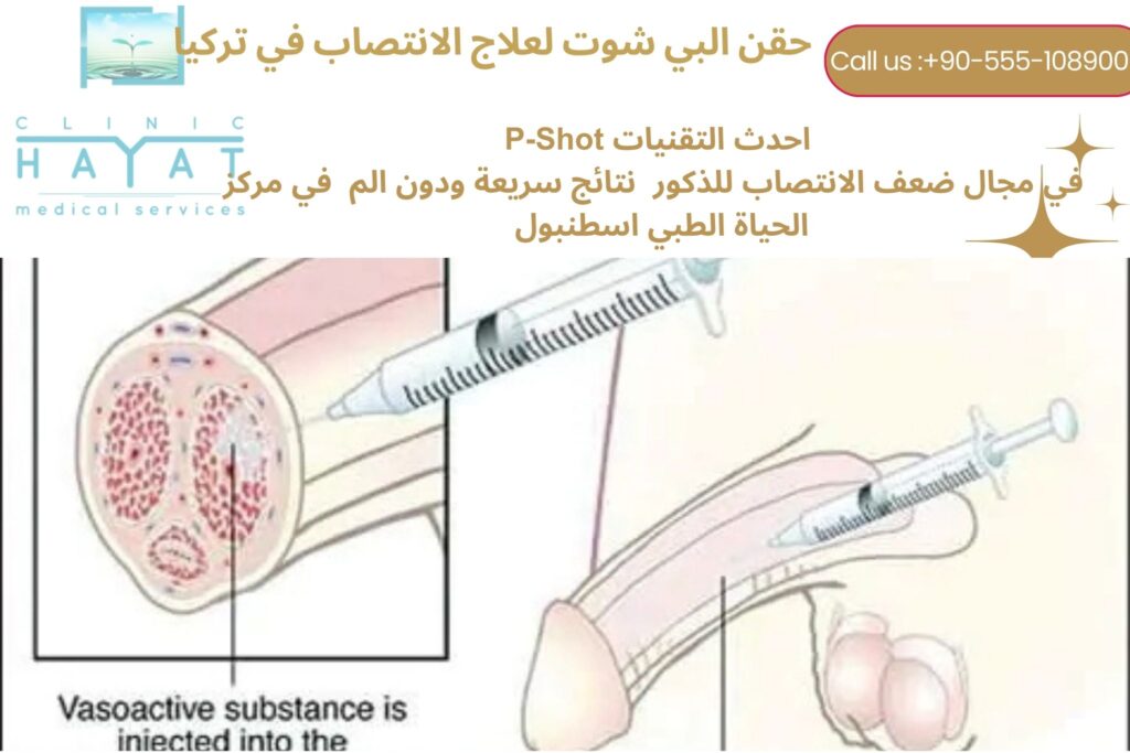 حقن البي شوت لعلاج ضعف الانتصاب في تركيا