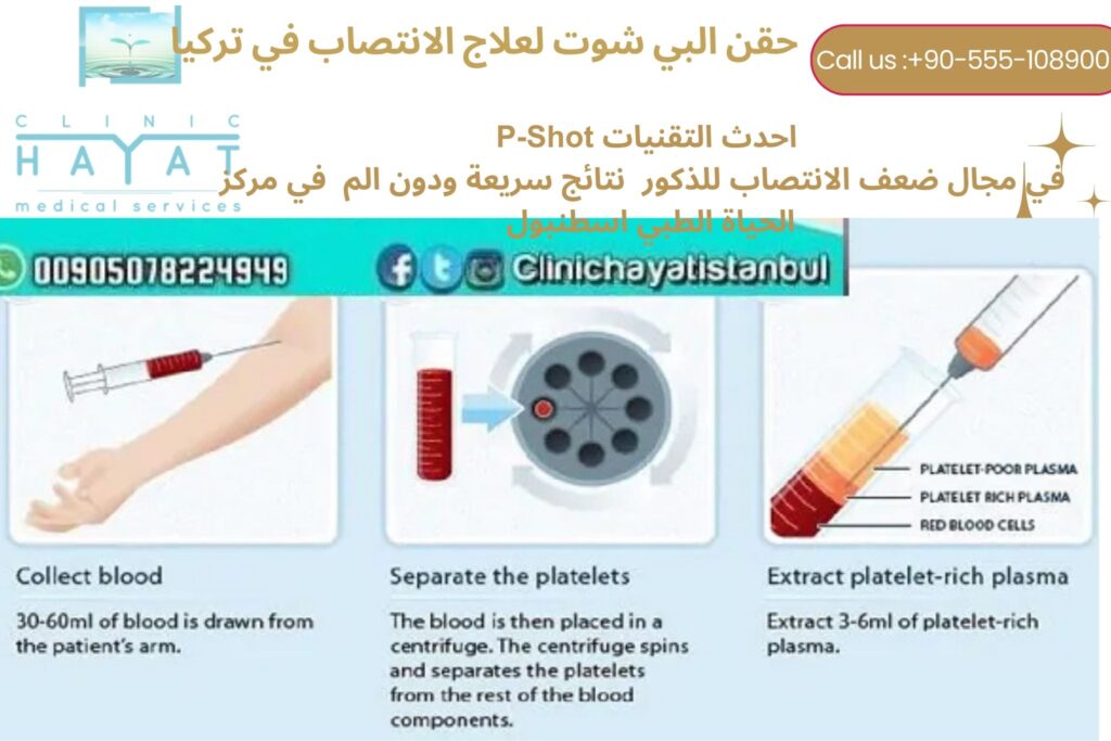 حقن البي شوت لعلاج ضعف الانتصاب في تركيا