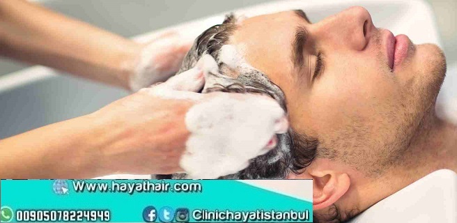 طريقة غسل الشعر بعد زراعة الشعر