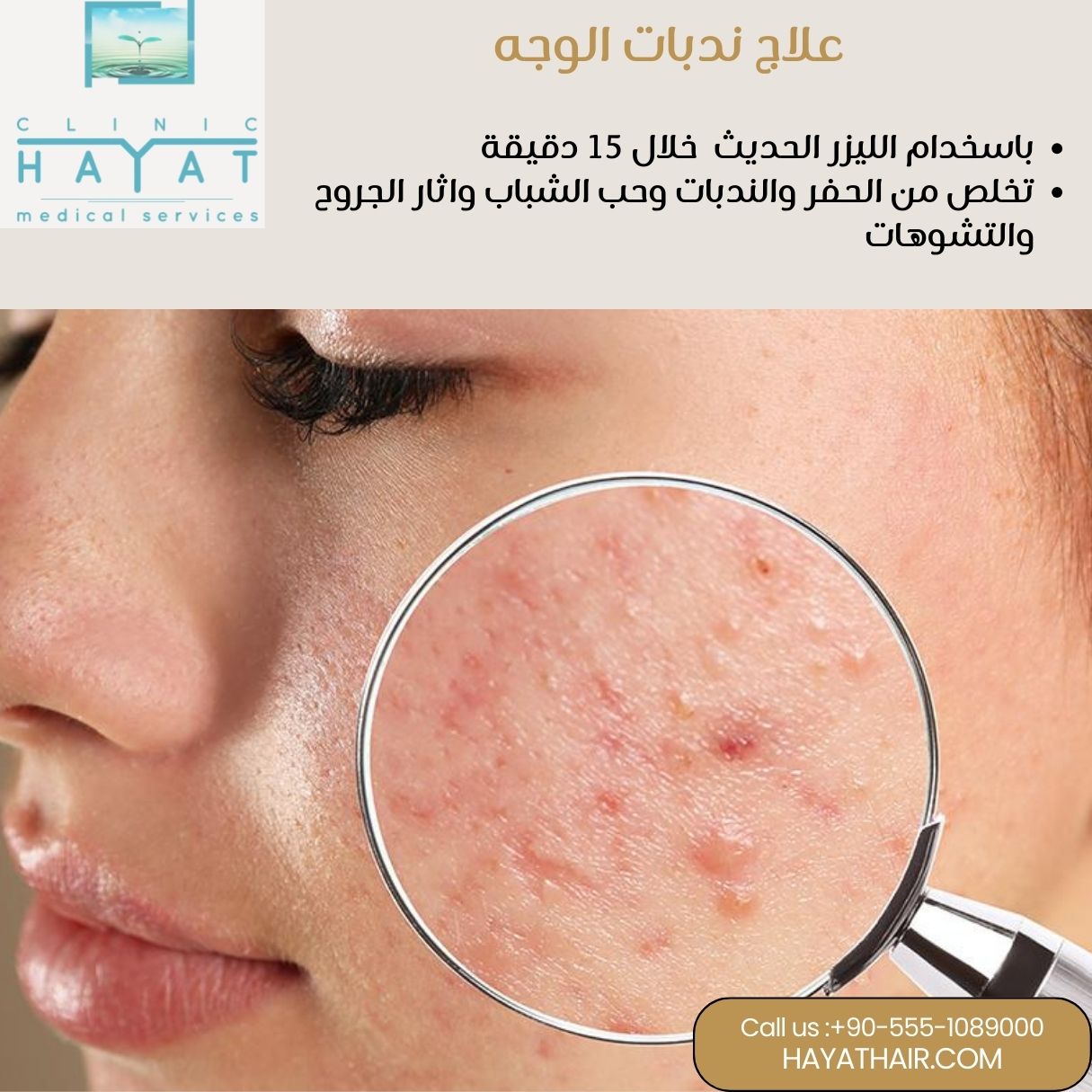 علاج ندبات الوجه في تركيا