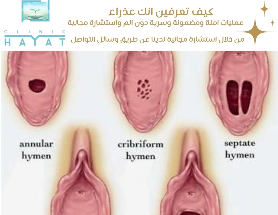 كيف تعرفين انك عذراء