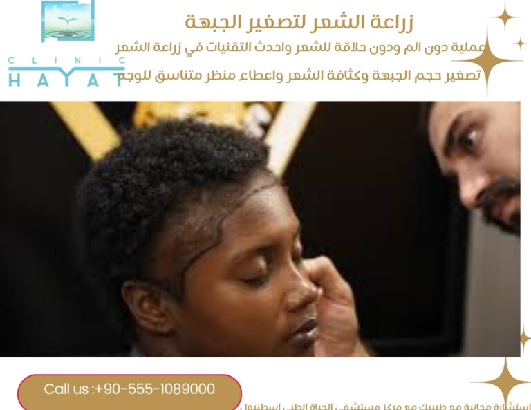 زراعة الشعر لتصغير الجبهة