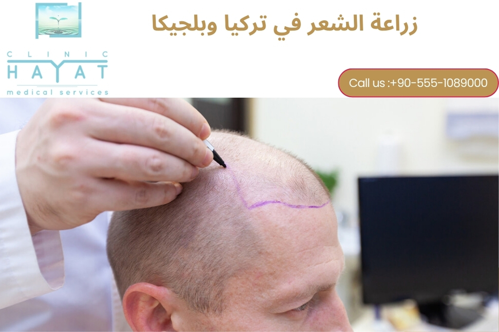 تكلفة زراعة الشعر في تركيا 2025