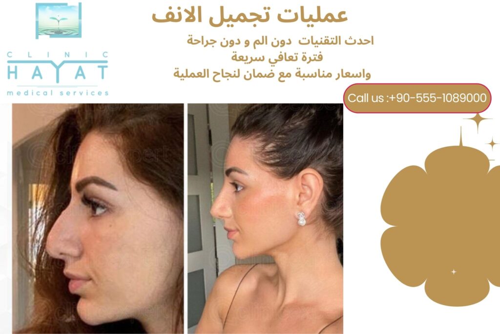 عمليات تجميل الانف قبل وبعد