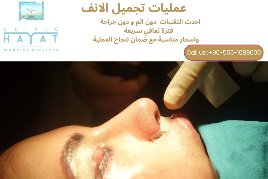 تجميل الأنف في تركيا 2026