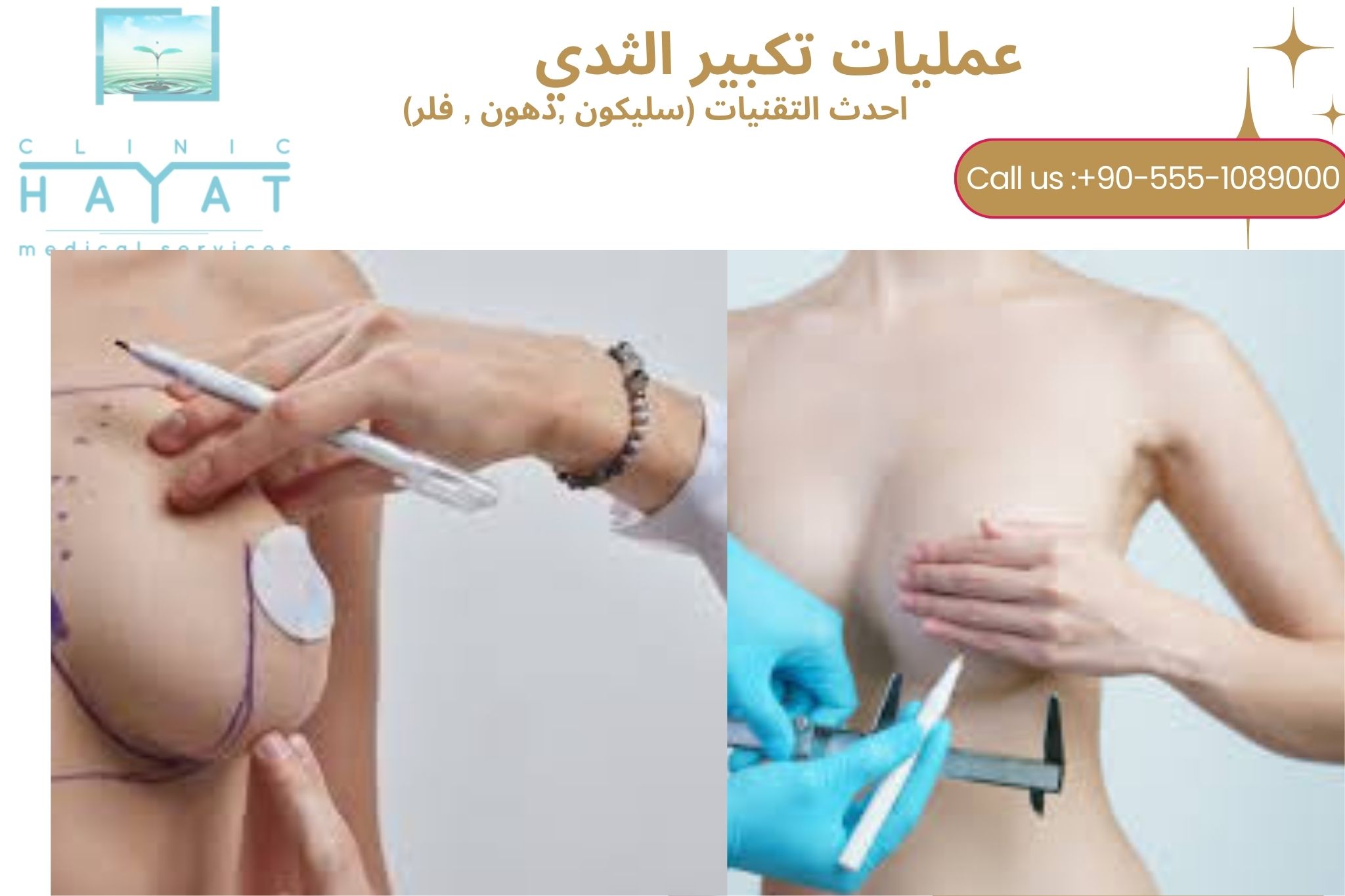 تكبير الثدي في تركيا