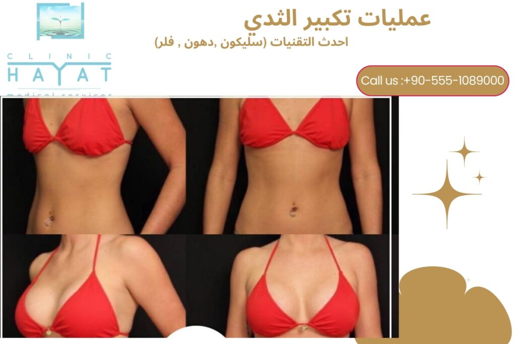 تكبير الثدي في تركيا 2026