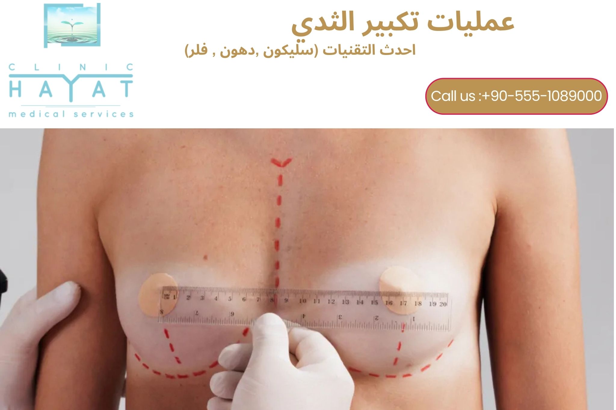 تكبير الثدي في تركيا 2026 | أفضل تقنيات وأفضل الأطباء