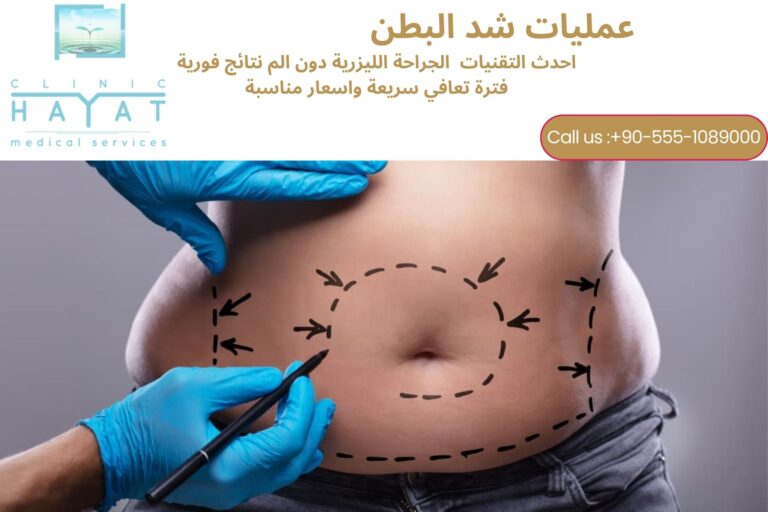 شد البطن في تركيا 2026 | أحدث تقنيات الحصول على بطن مشدود ومتناسق