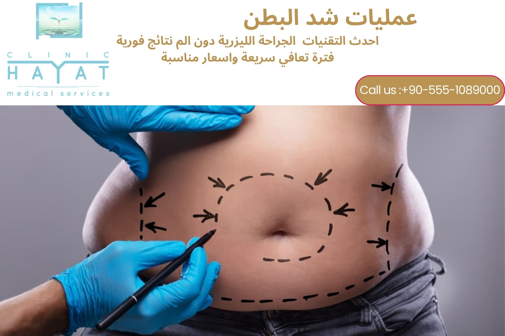 شد البطن في تركيا 2026 | أحدث تقنيات الحصول على بطن مشدود ومتناسق