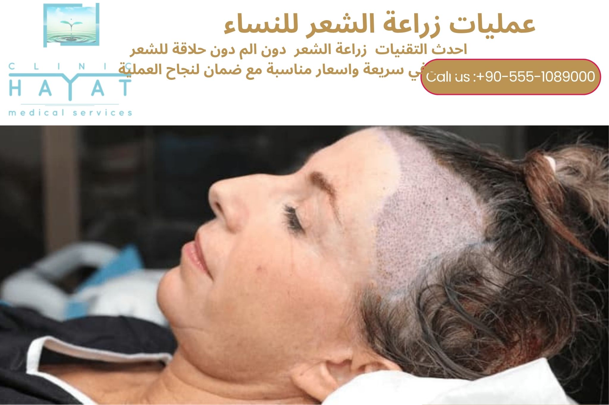 زراعة الشعر للنساء في تركيا 2026 | أحدث تقنيات استعادة كثافة الشعر