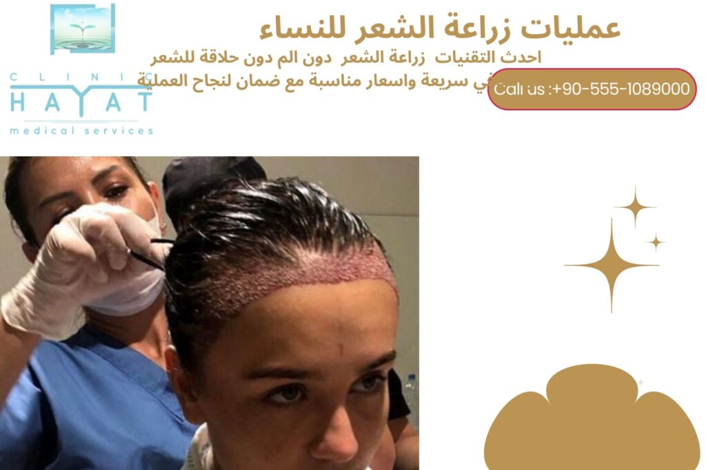 زراعة الشعر للنساء في تركيا 2026 | أحدث تقنيات استعادة كثافة الشعر
