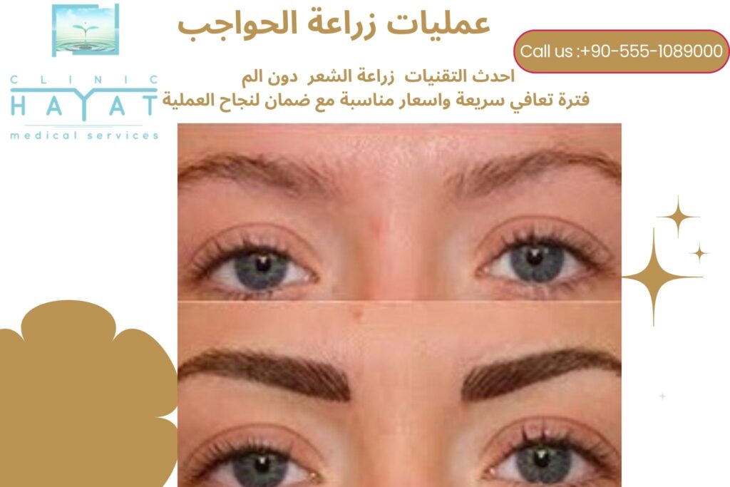 زراعة الحواجب في تركيا 2026 | أفضل تقنيات الحصول على حواجب كثيفة وطبيعية