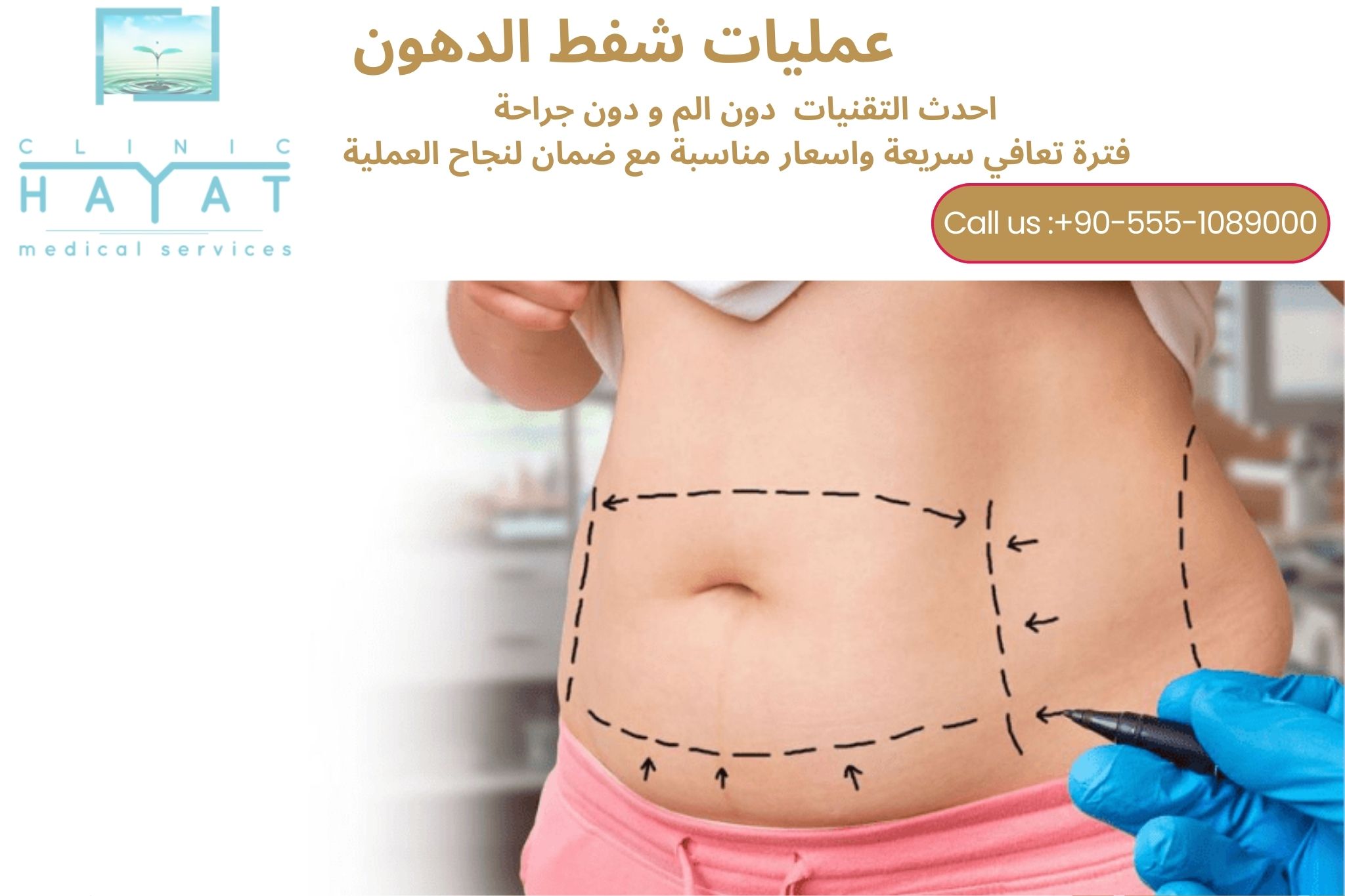شفط الدهون في تركيا 2026 | أفضل تقنيات إزالة الدهون وشد الجسم
