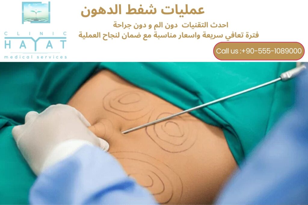 شفط الدهون في تركيا 2026