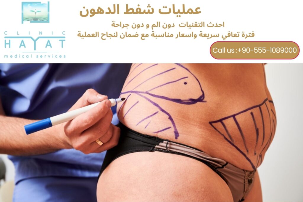 شفط الدهون في تركيا