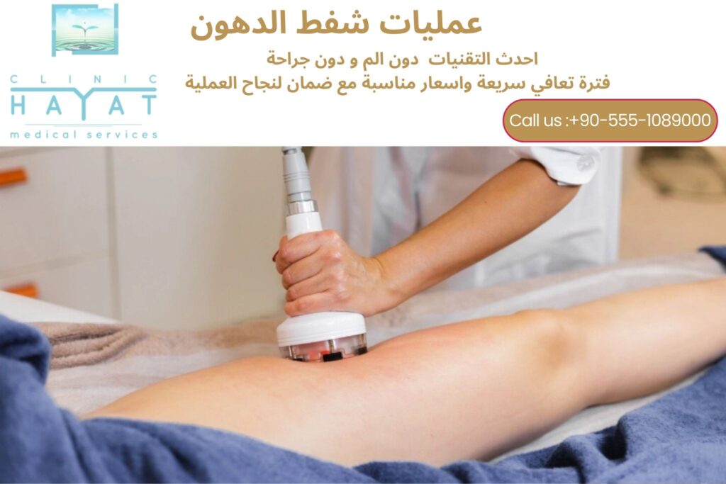 شفط الدهون في تركيا 2026