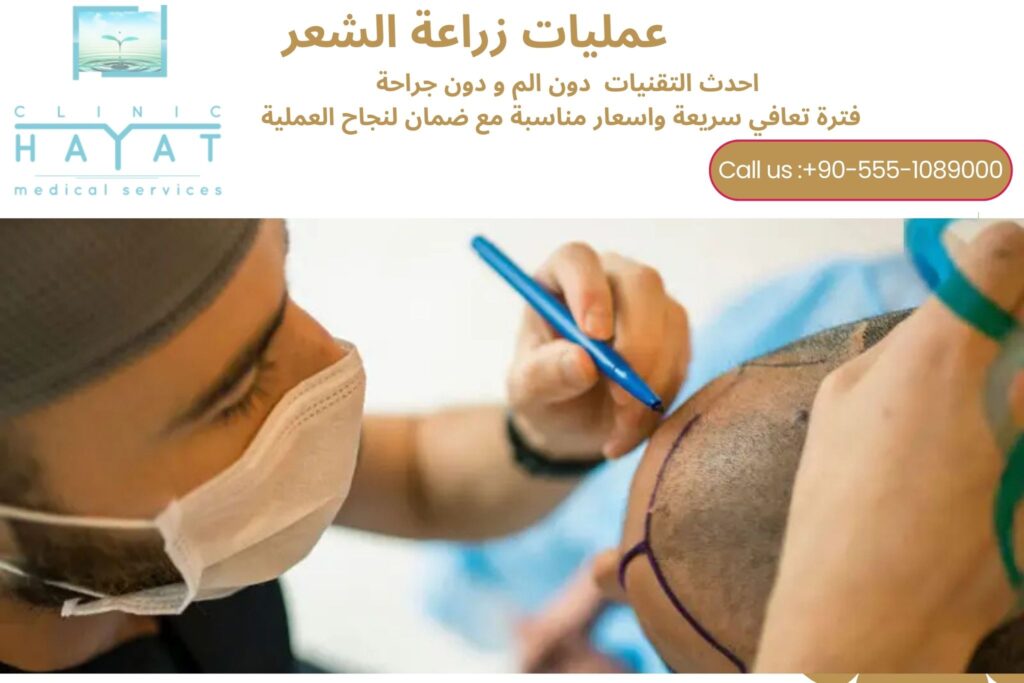 زراعة الشعر في تركيا 2026