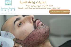 زراعة اللحية في تركيا 2026: أحدث التقنيات والتكاليف والنتائج الطبيعية للرجال