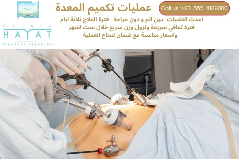 تكميم المعدة في تركيا 2026