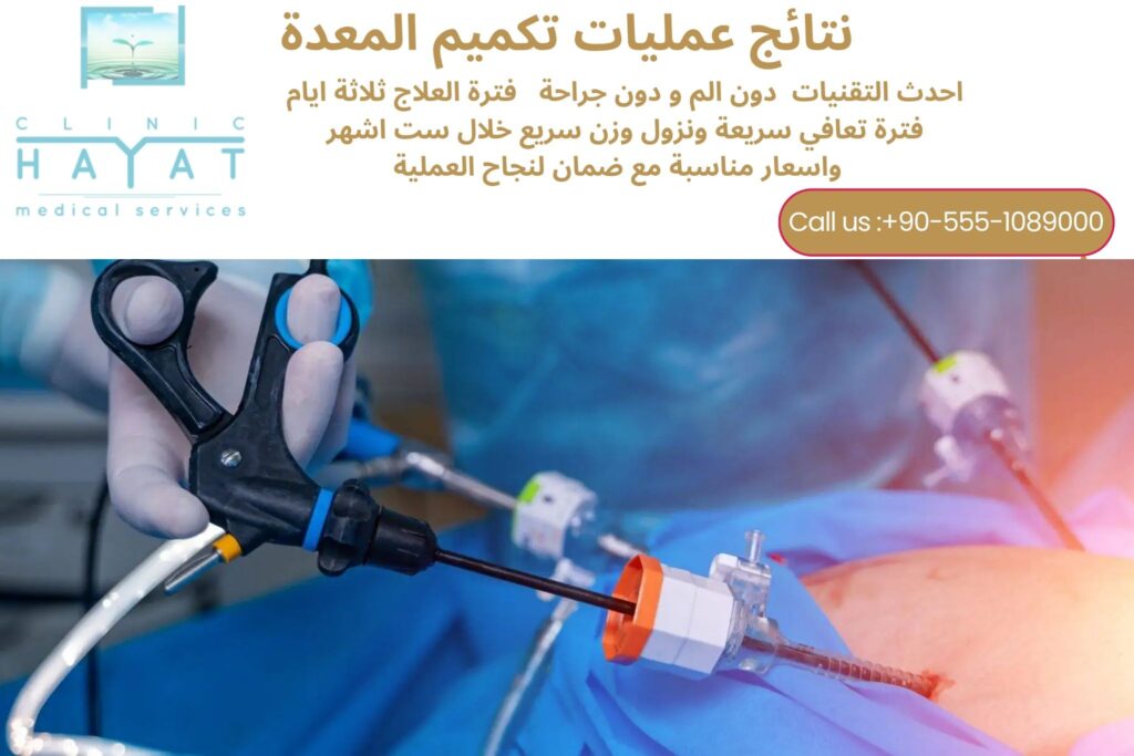 تصغير لمعدة في تركيا