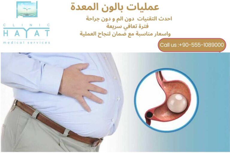 عملية بالون المعدة في تركيا 2026