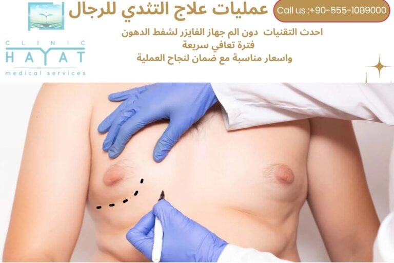 تصغير الثدي للرجال في تركيا 2026